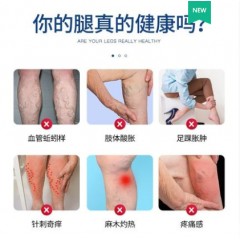 仁和静脉曲张型脉舒冷敷凝胶精索脉曲张药膏按摩缓解扩张专用