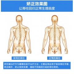 Ober脊柱侧弯矫正器拉伸纠正器高低肩男女成人儿童脊椎背部矫形器