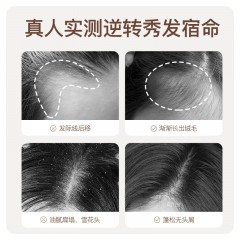 生姜防脱发固育发控油蓬松去屑止痒洗发水440ml*2